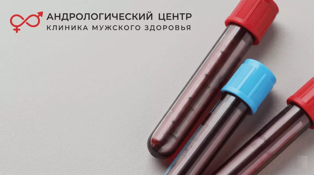 Какие анализы нужно сдать мужчине перед приемом уролога